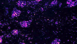 Nanopartz images web brain sections with Ramanprobes